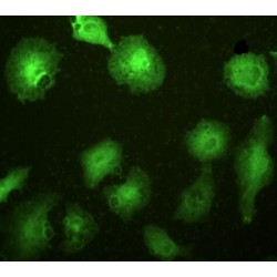 Interleukin 1 Receptor Like Protein 1 (IL1RL1) Antibody