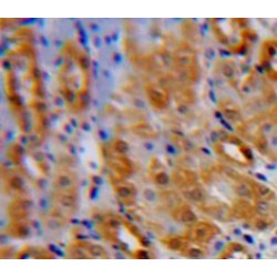 Interleukin 1 Receptor Like Protein 1 (IL1RL1) Antibody