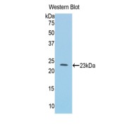 Western blot analysis of the recombinant protein.