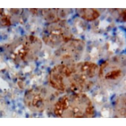 Interleukin 1 Receptor Like Protein 1 (IL1RL1) Antibody