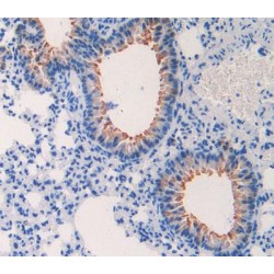 Macrophage Inflammatory Protein 1 Beta (MIP1b) Antibody