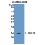 Western blot analysis of the recombinant protein.