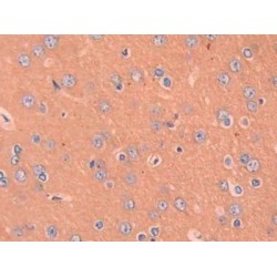 Macrophage Inflammatory Protein 1 Beta (MIP1b) Antibody