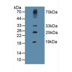 Procollagen Type III N-Terminal Propeptide (PIIINP) Antibody