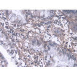 Procollagen Type III N-Terminal Propeptide (PIIINP) Antibody