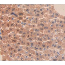 Protein Kinase, AMP Activated Gamma 2 (PRKAG2) Antibody