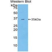 Western blot analysis of the recombinant protein.