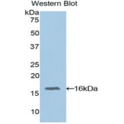 Western blot analysis of the recombinant protein.