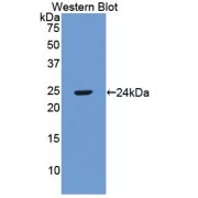 Western blot analysis of the recombinant protein.