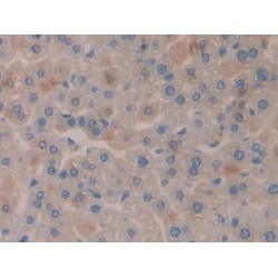 Serum/Glucocorticoid Regulated Kinase 3 (SGK3) Antibody