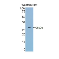 Sialic Acid Binding Ig Like Lectin 5 (SIGLEC5) Antibody