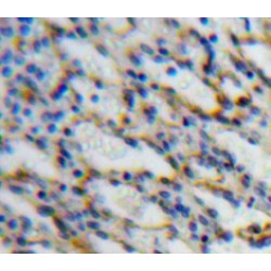 Sialic Acid Binding Ig Like Lectin 5 (SIGLEC5) Antibody