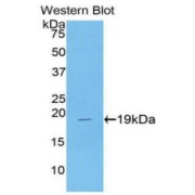 Western blot analysis of the recombinant protein.