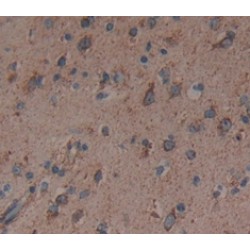 Colony Stimulating Factor 3, Granulocyte (GCSF) Antibody