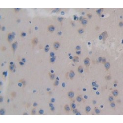 Colony Stimulating Factor 3, Granulocyte (GCSF) Antibody