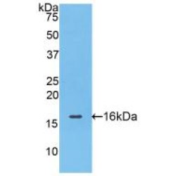 Fatty Acid Binding Protein 4, Adipocyte (FABP4) Antibody