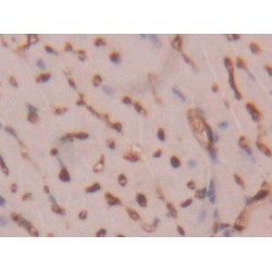 Fatty Acid Binding Protein 4, Adipocyte (FABP4) Antibody