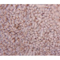 Fatty Acid Binding Protein 4, Adipocyte (FABP4) Antibody