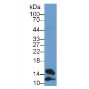 Western blot analysis of Rat Heart lysate, using Rat FABP4 Antibody (2 µg/ml) and HRP-conjugated Goat Anti-Rabbit antibody (<a href="https://www.abbexa.com/index.php?route=product/search&amp;search=abx400043" target="_blank">abx400043</a>, 0.2 µg/ml).