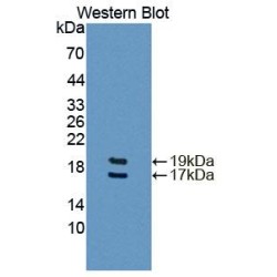 Fatty Acid Binding Protein 4, Adipocyte (FABP4) Antibody