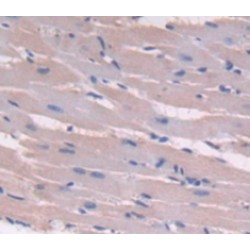 Fatty Acid Binding Protein 4, Adipocyte (FABP4) Antibody