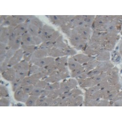 Fatty Acid Binding Protein 4, Adipocyte (FABP4) Antibody