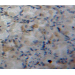 Fatty Acid Binding Protein 5, Epidermal (FABP5) Antibody