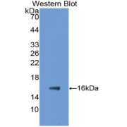 Western blot analysis of the recombinant protein.