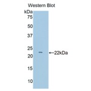 Western blot analysis of the recombinant protein.