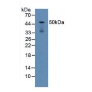 Western blot analysis of Mouse Lung Tissue.