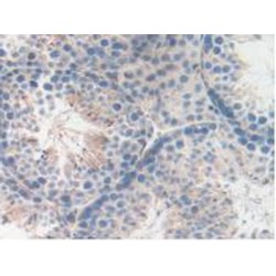 Lysosomal Associated Membrane Protein 2 (LAMP2) Antibody