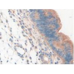 Lysosomal Associated Membrane Protein 2 (LAMP2) Antibody