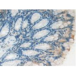 Lysosomal Associated Membrane Protein 2 (LAMP2) Antibody