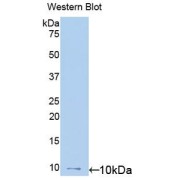 Western blot analysis of the recombinant protein.