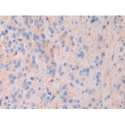 Matrix Extracellular Phosphoglycoprotein (MEPE) Antibody