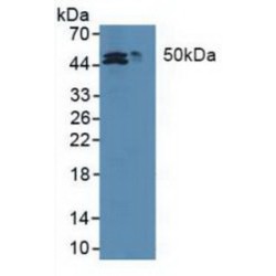 Methionine Adenosyltransferase II Alpha (MAT2a) Antibody