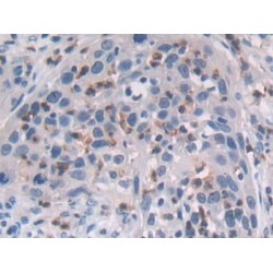 Methionine Adenosyltransferase II Alpha (MAT2a) Antibody