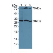 Western blot analysis of (1) Human HeLa cells, (2) Mouse Kidney Tissue and (3) Mouse Breast Cancer Tissue.