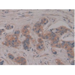 Pregnancy Specific Beta-1-Glycoprotein 1 (PSG1) Antibody