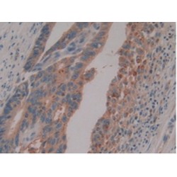 Pregnancy Specific Beta-1-Glycoprotein 1 (PSG1) Antibody