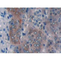 Carnitine Palmitoyltransferase 1A, Liver (CPT1A) Antibody