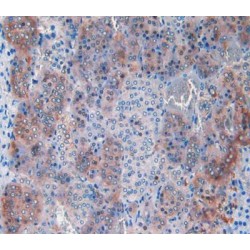 Carnitine Palmitoyltransferase 1A, Liver (CPT1A) Antibody