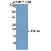 Western blot analysis of the recombinant protein.