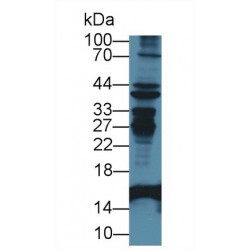 Fatty Acid-Binding Protein, Intestinal (FABP2) Antibody