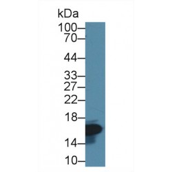 Fatty Acid-Binding Protein, Intestinal (FABP2) Antibody