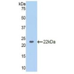 Glyceraldehyde-3-Phosphate Dehydrogenase (GAPDH) Antibody