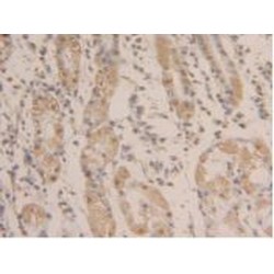 Glyceraldehyde-3-Phosphate Dehydrogenase (GAPDH) Antibody