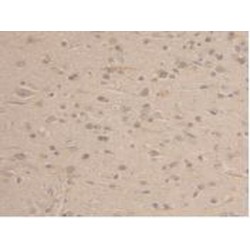 Glyceraldehyde-3-Phosphate Dehydrogenase (GAPDH) Antibody