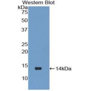 Western blot analysis of the recombinant protein.