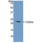 Western blot analysis of recombinant Human MPL.